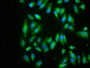 Immunofluorescence staining of Hela cells with CAC09020 at 1:266, counter-stained with DAPI. The cells were fixed in 4% formaldehyde, permeabilized using 0.2% Triton X-100 and blocked in 10% normal Goat Serum. The cells were then incubated with the antibody overnight at 4°C. The secondary antibody was Alexa Fluor 488-congugated AffiniPure Goat Anti-Rabbit IgG(H+L). Immunofluorescence staining of Hela cells with CAC09020 at 1:266, counter-stained with DAPI. The cells were fixed in 4% formaldehyde, permeabilized using 0.2% Triton X-100 and blocked in 10% normal Goat Serum. The cells were then incubated with the antibody overnight at 4°C. The secondary antibody was Alexa Fluor 488-congugated AffiniPure Goat Anti-Rabbit IgG(H+L).