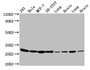 Western Blot; Positive WB detected in: 293 whole cell lysate, Hela whole cell lysate, MCF-7 whole cell lysate, SH-SY5Y whole cell lysate, Rat lung tissue, Rat brain tissue, Mouse lung tissue, Mouse brain tissue; All lanes: BCAP31 antibody at 4.8µg/ml; Secondary; Goat polyclonal to rabbit IgG at 1/50000 dilution; Predicted band size: 28, 35 kDa; Observed band size: 28 kDa Western Blot; Positive WB detected in: 293 whole cell lysate, Hela whole cell lysate, MCF-7 whole cell lysate, SH-SY5Y whole cell lysate, Rat lung tissue, Rat brain tissue, Mouse lung tissue, Mouse brain tissue; All lanes: BCAP31 antibody at 4.8µg/ml; Secondary; Goat polyclonal to rabbit IgG at 1/50000 dilution; Predicted band size: 28, 35 kDa; Observed band size: 28 kDa
