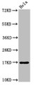 Western Blot; Positive WB detected in: Hela whole cell lysate; All lanes: C1D antibody at 3.2µg/ml; Secondary; Goat polyclonal to rabbit IgG at 1/50000 dilution; Predicted band size: 17 kDa; Observed band size: 17 kDa Western Blot; Positive WB detected in: Hela whole cell lysate; All lanes: C1D antibody at 3.2µg/ml; Secondary; Goat polyclonal to rabbit IgG at 1/50000 dilution; Predicted band size: 17 kDa; Observed band size: 17 kDa
