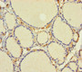 Immunohistochemistry of paraffin-embedded human thyroid tissue using CAC09029 at dilution of 1:100 Immunohistochemistry of paraffin-embedded human thyroid tissue using CAC09029 at dilution of 1:100