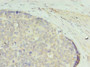 Immunohistochemistry of paraffin-embedded human gastric cancer using CAC09045 at dilution of 1:100