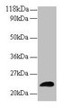 Western blot; All lanes: LCN2 antibody at 2µg/ml + Human positive serum; Secondary; Goat polyclonal to rabbit IgG at 1/15000 dilution; Predicted band size: 23 kDa; Observed band size: 23 kDa Western blot; All lanes: LCN2 antibody at 2µg/ml + Human positive serum; Secondary; Goat polyclonal to rabbit IgG at 1/15000 dilution; Predicted band size: 23 kDa; Observed band size: 23 kDa