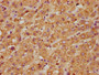 IHC image of CAC09088 diluted at 1:600 and staining in paraffin-embedded human liver tissue performed on a Leica BondTM system. After dewaxing and hydration, antigen retrieval was mediated by high pressure in a citrate buffer (pH 6.0). Section was blocked with 10% normal goat serum 30min at RT. Then primary antibody (1% BSA) was incubated at 4°C overnight. The primary is detected by a biotinylated secondary antibody and visualized using an HRP conjugated SP system. IHC image of CAC09088 diluted at 1:600 and staining in paraffin-embedded human liver tissue performed on a Leica BondTM system. After dewaxing and hydration, antigen retrieval was mediated by high pressure in a citrate buffer (pH 6.0). Section was blocked with 10% normal goat serum 30min at RT. Then primary antibody (1% BSA) was incubated at 4°C overnight. The primary is detected by a biotinylated secondary antibody and visualized using an HRP conjugated SP system.