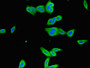 Immunofluorescent analysis of HepG2 cells using CAC09093 at dilution of 1:100 and Alexa Fluor 488-congugated AffiniPure Goat Anti-Rabbit IgG(H+L) Immunofluorescent analysis of HepG2 cells using CAC09093 at dilution of 1:100 and Alexa Fluor 488-congugated AffiniPure Goat Anti-Rabbit IgG(H+L)