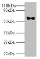Western blot; All lanes: Major capsid protein L1 antibody at 2µg/ml + 293T whole cell lysate; Secondary; Goat polyclonal to rabbit IgG at 1/10000 dilution; Predicted band size: 62 kDa; Observed band size: 62 kDa; Western blot; All lanes: Major capsid protein L1 antibody at 2µg/ml + 293T whole cell lysate; Secondary; Goat polyclonal to rabbit IgG at 1/10000 dilution; Predicted band size: 62 kDa; Observed band size: 62 kDa;