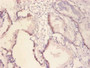Immunohistochemistry of paraffin-embedded human prostate tissue using CAC09113 at dilution of 1:100 Immunohistochemistry of paraffin-embedded human prostate tissue using CAC09113 at dilution of 1:100