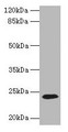 Western blot; , All lanes: CD3E antibody at 1.5µg/ml + Jurkat whole cell lysate; , Secondary; , Goat polyclonal to rabbit IgG at 1/10000 dilution; , Predicted band size: 24 kDa; , Observed band size: 24 kDa Western blot; , All lanes: CD3E antibody at 1.5µg/ml + Jurkat whole cell lysate; , Secondary; , Goat polyclonal to rabbit IgG at 1/10000 dilution; , Predicted band size: 24 kDa; , Observed band size: 24 kDa
