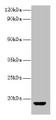 Western blot; All lanes: AVP antibody at 2µg/ml + Rat gonadal tissue; Secondary; Goat polyclonal to rabbit IgG at 1/10000 dilution; Predicted band size: 18 kDa; Observed band size: 18 kDa Western blot; All lanes: AVP antibody at 2µg/ml + Rat gonadal tissue; Secondary; Goat polyclonal to rabbit IgG at 1/10000 dilution; Predicted band size: 18 kDa; Observed band size: 18 kDa