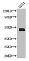 Western Blot; Positive WB detected in: U251 whole cell lysate; All lanes: SERPINE1 antibody at 2.5µg/ml; Secondary; Goat polyclonal to rabbit IgG at 1/50000 dilution; Predicted band size: 46, 44 kDa; Observed band size: 46, 44 kDa Western Blot; Positive WB detected in: U251 whole cell lysate; All lanes: SERPINE1 antibody at 2.5µg/ml; Secondary; Goat polyclonal to rabbit IgG at 1/50000 dilution; Predicted band size: 46, 44 kDa; Observed band size: 46, 44 kDa