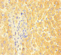 Immunohistochemistry of paraffin-embedded human liver tissue using CAC09155 at dilution of 1:100 Immunohistochemistry of paraffin-embedded human liver tissue using CAC09155 at dilution of 1:100