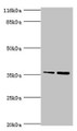 Western blot; All lanes: CFHR2 antibody at 2µg/ml; Lane 1: Hela whole cell lysate; Lane 2: 293T whole cell lysate; Secondary; Goat polyclonal to rabbit IgG at 1/10000 dilution; Predicted band size: 31, 28 kDa; Observed band size: 36 kDa