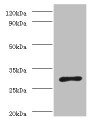 Western blot; All lanes: ureA antibody at 2µg/ml + Helicobacter pylori bacteria liquid; Secondary; Goat polyclonal to rabbit IgG at 1/10000 dilution; Predicted band size: 27 kDa; Observed band size: 27 kDa Western blot; All lanes: ureA antibody at 2µg/ml + Helicobacter pylori bacteria liquid; Secondary; Goat polyclonal to rabbit IgG at 1/10000 dilution; Predicted band size: 27 kDa; Observed band size: 27 kDa