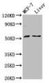 Western Blot; Positive WB detected in: MCF-7 whole cell lysate, Rat liver tissue; All lanes: AKT2 antibody at 2.8µg/ml; Secondary; Goat polyclonal to rabbit IgG at 1/50000 dilution; Predicted band size: 56, 52 kDa; Observed band size: 56 kDa Western Blot; Positive WB detected in: MCF-7 whole cell lysate, Rat liver tissue; All lanes: AKT2 antibody at 2.8µg/ml; Secondary; Goat polyclonal to rabbit IgG at 1/50000 dilution; Predicted band size: 56, 52 kDa; Observed band size: 56 kDa