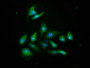 Immunofluorescence staining of A549 cells with CAC09191 at 1:466, counter-stained with DAPI. The cells were fixed in 4% formaldehyde, permeabilized using 0.2% Triton X-100 and blocked in 10% normal Goat Serum. The cells were then incubated with the antibody overnight at 4°C. The secondary antibody was Alexa Fluor 488-congugated AffiniPure Goat Anti-Rabbit IgG(H+L). Immunofluorescence staining of A549 cells with CAC09191 at 1:466, counter-stained with DAPI. The cells were fixed in 4% formaldehyde, permeabilized using 0.2% Triton X-100 and blocked in 10% normal Goat Serum. The cells were then incubated with the antibody overnight at 4°C. The secondary antibody was Alexa Fluor 488-congugated AffiniPure Goat Anti-Rabbit IgG(H+L).
