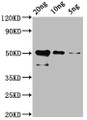 Western Blot; Positive WB detected in: Recombinant cry1Ac protein at 20ng, 10ng, 5ng ; All lanes: cry1Ac antibody at 1:2000; Secondary; Goat polyclonal to rabbit IgG at 1/50000 dilution; Predicted band size: 51 kDa; Observed band size: 51 kDa; Western Blot; Positive WB detected in: Recombinant cry1Ac protein at 20ng, 10ng, 5ng ; All lanes: cry1Ac antibody at 1:2000; Secondary; Goat polyclonal to rabbit IgG at 1/50000 dilution; Predicted band size: 51 kDa; Observed band size: 51 kDa;