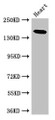 Western Blot; Positive WB detected in: Mouse heart tissue; All lanes: MYBPC-3 antibody at 2.5µg/ml; Secondary; Goat polyclonal to rabbit IgG at 1/50000 dilution; Predicted band size: 141 kDa; Observed band size: 141 kDa;