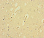 Immunohistochemistry of paraffin-embedded human brain tissue using CAC09256 at dilution of 1:100 Immunohistochemistry of paraffin-embedded human brain tissue using CAC09256 at dilution of 1:100