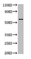 Western Blot; Positive WB detected in: U87 whole cell lysate; All lanes: DPYSL2 antibody at 4µg/ml; Secondary; Goat polyclonal to rabbit IgG at 1/50000 dilution; Predicted band size: 63, 59 kDa; Observed band size: 63 kDa
