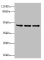Western blot; All lanes: FAM53B antibody at 2µg/ml; Lane 1: MCF-7 whole cell lysate; Lane 2: A549 whole cell lysate; Lane 3: HCT116 whole cell lysate; Secondary; Goat polyclonal to rabbit IgG at 1/10000 dilution; Predicted band size: 46, 34 kDa; Observed band size: 46 kDa Western blot; All lanes: FAM53B antibody at 2µg/ml; Lane 1: MCF-7 whole cell lysate; Lane 2: A549 whole cell lysate; Lane 3: HCT116 whole cell lysate; Secondary; Goat polyclonal to rabbit IgG at 1/10000 dilution; Predicted band size: 46, 34 kDa; Observed band size: 46 kDa