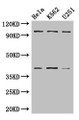 Western Blot; Positive WB detected in: Hela whole cell lysate, K562 whole cell lysate, U251 whole cell lysate; All lanes: PSMD2 antibody at 3µg/ml; Secondary; Goat polyclonal to rabbit IgG at 1/50000 dilution; Predicted band size: 101, 83, 86 kDa; Observed band size: 101, 40 kDa Western Blot; Positive WB detected in: Hela whole cell lysate, K562 whole cell lysate, U251 whole cell lysate; All lanes: PSMD2 antibody at 3µg/ml; Secondary; Goat polyclonal to rabbit IgG at 1/50000 dilution; Predicted band size: 101, 83, 86 kDa; Observed band size: 101, 40 kDa