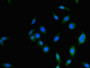Immunofluorescence staining of Hela cells with CAC09285 at 1:333, counter-stained with DAPI. The cells were fixed in 4% formaldehyde, permeabilized using 0.2% Triton X-100 and blocked in 10% normal Goat Serum. The cells were then incubated with the antibody overnight at 4°C. The secondary antibody was Alexa Fluor 488-congugated AffiniPure Goat Anti-Rabbit IgG(H+L). Immunofluorescence staining of Hela cells with CAC09285 at 1:333, counter-stained with DAPI. The cells were fixed in 4% formaldehyde, permeabilized using 0.2% Triton X-100 and blocked in 10% normal Goat Serum. The cells were then incubated with the antibody overnight at 4°C. The secondary antibody was Alexa Fluor 488-congugated AffiniPure Goat Anti-Rabbit IgG(H+L).