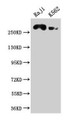 Western Blot; ,Positive WB detected in: Raji whole cell lysate, K562 whole cell lysate; ,All lanes: ATR antibody at 1:2000; ,Secondary; ,Goat polyclonal to rabbit IgG at 1/50000 dilution; ,Predicted band size: 302, 295, 298 kDa; ,Observed band size: 302 kDa Western Blot; ,Positive WB detected in: Raji whole cell lysate, K562 whole cell lysate; ,All lanes: ATR antibody at 1:2000; ,Secondary; ,Goat polyclonal to rabbit IgG at 1/50000 dilution; ,Predicted band size: 302, 295, 298 kDa; ,Observed band size: 302 kDa