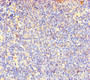 Immunohistochemistry of paraffin-embedded human lymphoid tissue using CAC09299 at dilution of 1:100 Immunohistochemistry of paraffin-embedded human lymphoid tissue using CAC09299 at dilution of 1:100