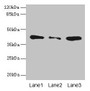 Western blot; All lanes: SGCA antibody at 0.5µg/ml; Lane 1: Jurkat whole cell lysate; Lane 2: HepG2 whole cell lysate; Lane 3: 293T whole cell lysate; Secondary; Goat polyclonal to rabbit IgG at 1/10000 dilution; Predicted band size: 43, 30 kDa; Observed band size: 43 kDa Western blot; All lanes: SGCA antibody at 0.5µg/ml; Lane 1: Jurkat whole cell lysate; Lane 2: HepG2 whole cell lysate; Lane 3: 293T whole cell lysate; Secondary; Goat polyclonal to rabbit IgG at 1/10000 dilution; Predicted band size: 43, 30 kDa; Observed band size: 43 kDa