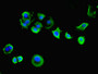Immunofluorescent analysis of MCF-7 cells using CAC09306 at dilution of 1:100 and Alexa Fluor 488-congugated AffiniPure Goat Anti-Rabbit IgG(H+L) Immunofluorescent analysis of MCF-7 cells using CAC09306 at dilution of 1:100 and Alexa Fluor 488-congugated AffiniPure Goat Anti-Rabbit IgG(H+L)