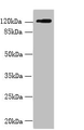 Western blot; All lanes: SLC4A8 antibody at 2µg/ml + Hela whole cell lysate; Secondary; Goat polyclonal to rabbit IgG at 1/10000 dilution; Predicted band size: 123, 121, 118, 112, 78, 84, 72 kDa; Observed band size: 123 kDa Western blot; All lanes: SLC4A8 antibody at 2µg/ml + Hela whole cell lysate; Secondary; Goat polyclonal to rabbit IgG at 1/10000 dilution; Predicted band size: 123, 121, 118, 112, 78, 84, 72 kDa; Observed band size: 123 kDa