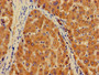 Immunohistochemistry of paraffin-embedded human liver tissue using CAC09327 at dilution of 1:100 Immunohistochemistry of paraffin-embedded human liver tissue using CAC09327 at dilution of 1:100