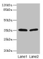 Western blot; All lanes: HSD17B12 antibody at 1.2µg/ml; Lane 1: U251 whole cell lysate; Lane 2: A431 whole cell lysate; Secondary; Goat polyclonal to rabbit IgG at 1/10000 dilution; Predicted band size: 35, 11 kDa; Observed band size: 35 kDa
