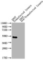 Western Blot; Positive WB detected in: pat 293T Transfected lysate, 293T non-Transfected lysate; All lanes: pat antibody at 1:2000; Secondary; Goat polyclonal to rabbit IgG at 1/50000 dilution; Predicted band size: 49 kDa; Observed band size: 49 kDa; Western Blot; Positive WB detected in: pat 293T Transfected lysate, 293T non-Transfected lysate; All lanes: pat antibody at 1:2000; Secondary; Goat polyclonal to rabbit IgG at 1/50000 dilution; Predicted band size: 49 kDa; Observed band size: 49 kDa;