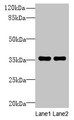 Western blot; All lanes: NAIF1 antibody at 6µg/ml; Lane 1: Mouse brain tissue; Lane 2: Mouse heart tissue; Secondary; Goat polyclonal to rabbit IgG at 1/10000 dilution; Predicted band size: 36, 18 kDa; Observed band size: 36 kDa Western blot; All lanes: NAIF1 antibody at 6µg/ml; Lane 1: Mouse brain tissue; Lane 2: Mouse heart tissue; Secondary; Goat polyclonal to rabbit IgG at 1/10000 dilution; Predicted band size: 36, 18 kDa; Observed band size: 36 kDa