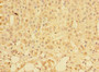 Immunohistochemistry of paraffin-embedded human adrenal gland tissue using CAC09356 at dilution of 1:100 Immunohistochemistry of paraffin-embedded human adrenal gland tissue using CAC09356 at dilution of 1:100