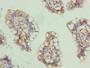 Immunohistochemistry of paraffin-embedded human small intestine tissue using CAC09362 at dilution of 1:100 Immunohistochemistry of paraffin-embedded human small intestine tissue using CAC09362 at dilution of 1:100