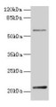 Western blot; All lanes: DUSP13 antibody at 4µg/ml + Hela whole cell lysate; Secondary; Goat polyclonal to rabbit IgG at 1/10000 dilution; Predicted band size: 21, 23, 7, 28, 8, 10, 18 kDa; Observed band size: 21 kDa Western blot; All lanes: DUSP13 antibody at 4µg/ml + Hela whole cell lysate; Secondary; Goat polyclonal to rabbit IgG at 1/10000 dilution; Predicted band size: 21, 23, 7, 28, 8, 10, 18 kDa; Observed band size: 21 kDa