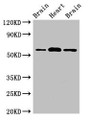 Western Blot; , Positive WB detected in: Rat brain tissue, Mouse heart tissue, Mouse brain tissue; , All lanes: ATG14 antibody at 2µg/ml; , Secondary; , Goat polyclonal to rabbit IgG at 1/50000 dilution; , Predicted band size: 56, 43 kDa; , Observed band size: 56 kDa; Western Blot; , Positive WB detected in: Rat brain tissue, Mouse heart tissue, Mouse brain tissue; , All lanes: ATG14 antibody at 2µg/ml; , Secondary; , Goat polyclonal to rabbit IgG at 1/50000 dilution; , Predicted band size: 56, 43 kDa; , Observed band size: 56 kDa;