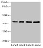 Western blot; All lanes: SFXN4 antibody at 0.3µg/ml; Lane 1: K562 whole cell lysate; Lane 2: U251 whole cell lysate; Lane 3: U87 whole cell lysate; Lane 4: A549 whole cell lysate; Secondary; Goat polyclonal to rabbit IgG at 1/10000 dilution; Predicted band size: 38, 35, 25 kDa; Observed band size: 38 kDa Western blot; All lanes: SFXN4 antibody at 0.3µg/ml; Lane 1: K562 whole cell lysate; Lane 2: U251 whole cell lysate; Lane 3: U87 whole cell lysate; Lane 4: A549 whole cell lysate; Secondary; Goat polyclonal to rabbit IgG at 1/10000 dilution; Predicted band size: 38, 35, 25 kDa; Observed band size: 38 kDa