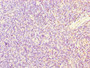 Immunohistochemistry of paraffin-embedded human thymus tissue using CAC09386 at dilution of 1:100 Immunohistochemistry of paraffin-embedded human thymus tissue using CAC09386 at dilution of 1:100
