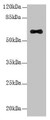 Western Blot; All lanes: LRRC31 antibody at 5µg/ml + Mouse small intestine tissue; Secondary; Goat polyclonal to rabbit IgG at 1/10000 dilution; Predicted band size: 62, 56, 39, 49 kDa; Observed band size: 62 kDa Western Blot; All lanes: LRRC31 antibody at 5µg/ml + Mouse small intestine tissue; Secondary; Goat polyclonal to rabbit IgG at 1/10000 dilution; Predicted band size: 62, 56, 39, 49 kDa; Observed band size: 62 kDa