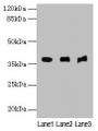Western blot; All lanes: MRNIP antibody at 4µg/ml; Lane 1: Mouse kidney tissue; Lane 2: Mouse heart tissue; Lane 3: Hela whole cell lysate; Secondary; Goat polyclonal to rabbit IgG at 1/10000 dilution; Predicted band size: 38, 30, 32 kDa; Observed band size: 38 kDa Western blot; All lanes: MRNIP antibody at 4µg/ml; Lane 1: Mouse kidney tissue; Lane 2: Mouse heart tissue; Lane 3: Hela whole cell lysate; Secondary; Goat polyclonal to rabbit IgG at 1/10000 dilution; Predicted band size: 38, 30, 32 kDa; Observed band size: 38 kDa