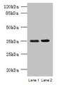 Western blot; All lanes: CFAP65 antibody at 8µg/ml; Lane 1: U251 whole cell lysate; Lane 2: U87 whole cell lysate; Secondary; Goat polyclonal to rabbit IgG at 1/10000 dilution; Predicted band size: 218, 19, 82, 88 kDa; Observed band size: 35 kDa Western blot; All lanes: CFAP65 antibody at 8µg/ml; Lane 1: U251 whole cell lysate; Lane 2: U87 whole cell lysate; Secondary; Goat polyclonal to rabbit IgG at 1/10000 dilution; Predicted band size: 218, 19, 82, 88 kDa; Observed band size: 35 kDa