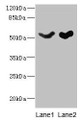 Western blot; All lanes: SLC25A25 antibody at 10µg/ml; Lane 1: Mouse liver tissue; Lane 2: Mouse brain tissue; Secondary; Goat polyclonal to rabbit IgG at 1/10000 dilution; Predicted band size: 53, 56, 57, 55, 41 kDa; Observed band size: 53 kDa Western blot; All lanes: SLC25A25 antibody at 10µg/ml; Lane 1: Mouse liver tissue; Lane 2: Mouse brain tissue; Secondary; Goat polyclonal to rabbit IgG at 1/10000 dilution; Predicted band size: 53, 56, 57, 55, 41 kDa; Observed band size: 53 kDa