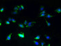 Immunofluorescent analysis of U251 cells using CAC09414 at dilution of 1:100 and Alexa Fluor 488-congugated AffiniPure Goat Anti-Rabbit IgG(H+L) Immunofluorescent analysis of U251 cells using CAC09414 at dilution of 1:100 and Alexa Fluor 488-congugated AffiniPure Goat Anti-Rabbit IgG(H+L)