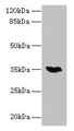 Western blot; All lanes: LYSMD3 antibody at 6µg/ml + Mouse heart tissue; Secondary; Goat polyclonal to rabbit IgG at 1/10000 dilution; Predicted band size: 35, 15, 18 kDa; Observed band size: 35 kDa Western blot; All lanes: LYSMD3 antibody at 6µg/ml + Mouse heart tissue; Secondary; Goat polyclonal to rabbit IgG at 1/10000 dilution; Predicted band size: 35, 15, 18 kDa; Observed band size: 35 kDa