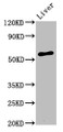 Western Blot; Positive WB detected in: Rat liver tissue; All lanes: AMIGO2 antibody at 3.2µg/ml; Secondary; Goat polyclonal to rabbit IgG at 1/50000 dilution; Predicted band size: 58 kDa; Observed band size: 58 kDa Western Blot; Positive WB detected in: Rat liver tissue; All lanes: AMIGO2 antibody at 3.2µg/ml; Secondary; Goat polyclonal to rabbit IgG at 1/50000 dilution; Predicted band size: 58 kDa; Observed band size: 58 kDa