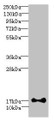 Western blot; All lanes: ISCA2 antibody at 0.4µg/ml + HL60 whole cell lysate; Secondary; Goat polyclonal to rabbit IgG at 1/10000 dilution; Predicted band size: 17, 7 kDa; Observed band size: 17 kDa Western blot; All lanes: ISCA2 antibody at 0.4µg/ml + HL60 whole cell lysate; Secondary; Goat polyclonal to rabbit IgG at 1/10000 dilution; Predicted band size: 17, 7 kDa; Observed band size: 17 kDa
