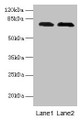 Western blot; All lanes: GALNT7 antibody at 0.1µg/ml; Lane 1: Hela whole cell lysate; Lane 2: HepG2 whole cell lysate; Secondary; Goat polyclonal to rabbit IgG at 1/10000 dilution; Predicted band size: 76 kDa; Observed band size: 76 kDa Western blot; All lanes: GALNT7 antibody at 0.1µg/ml; Lane 1: Hela whole cell lysate; Lane 2: HepG2 whole cell lysate; Secondary; Goat polyclonal to rabbit IgG at 1/10000 dilution; Predicted band size: 76 kDa; Observed band size: 76 kDa