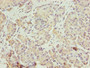 Immunohistochemistry of paraffin-embedded human pancreatic tissue using CAC09445 at dilution of 1:100 Immunohistochemistry of paraffin-embedded human pancreatic tissue using CAC09445 at dilution of 1:100